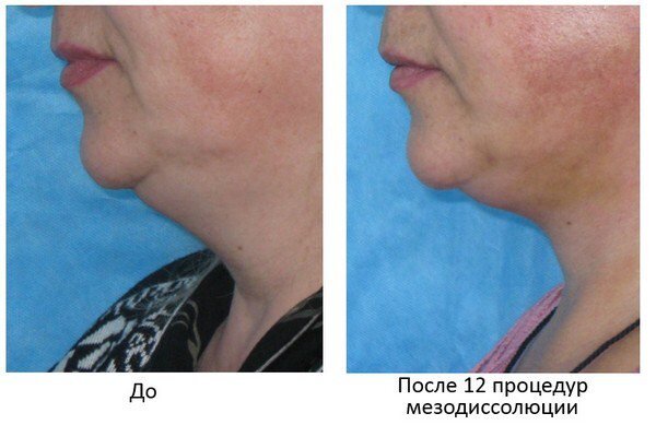 Яндекс картинки.