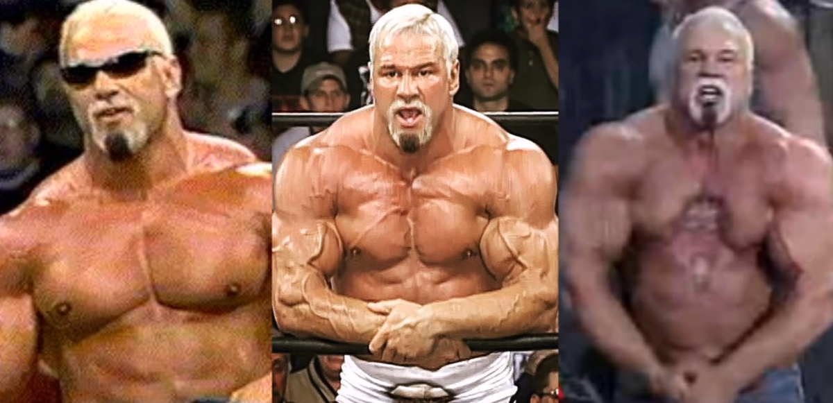 Скотт Штайнер