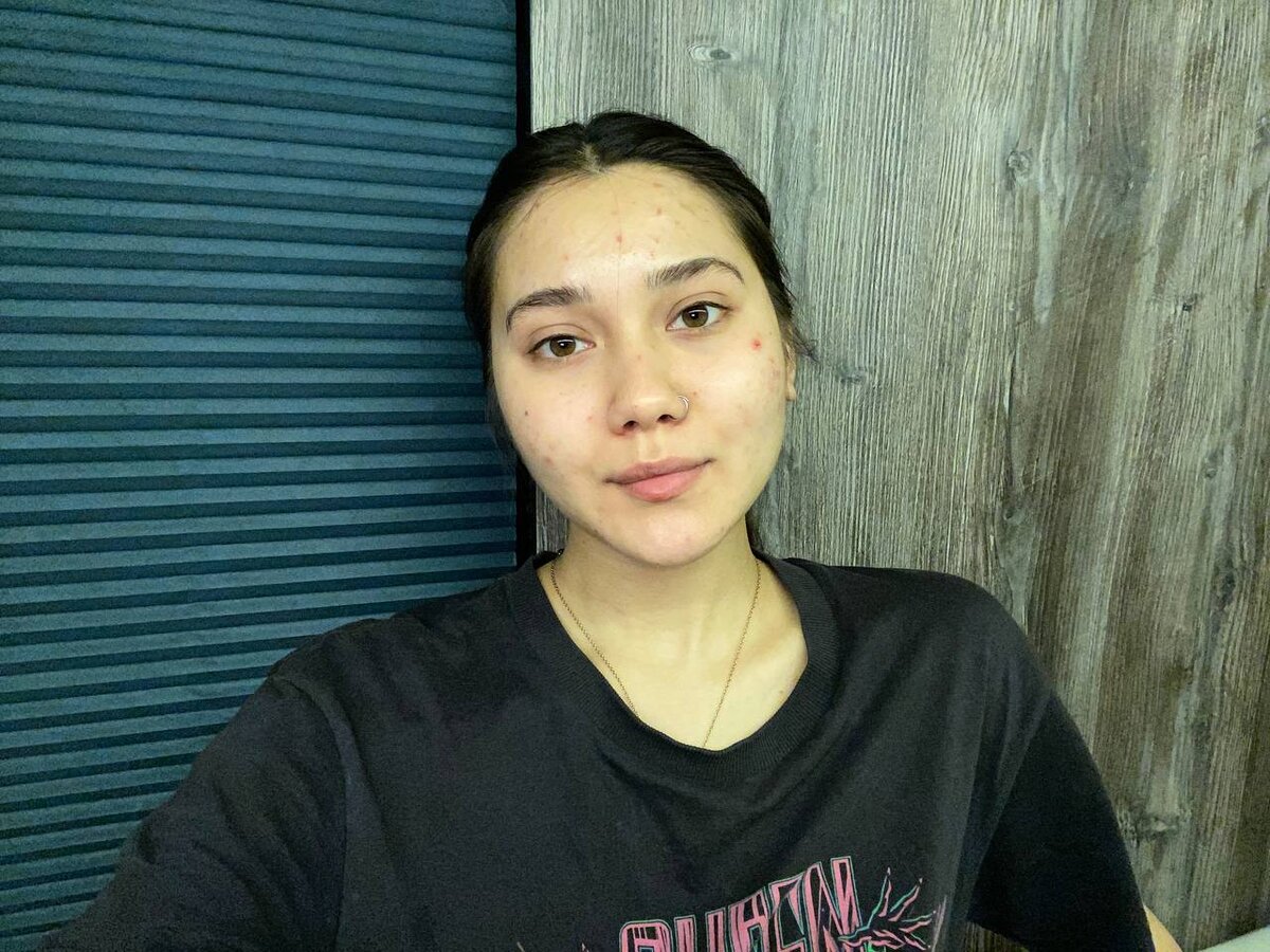 Это меня атаковали высыпания