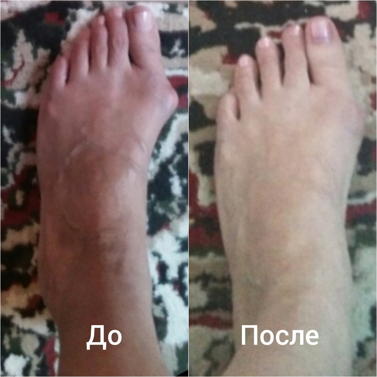 Результат занятий по комплексной системе оздоровления и омоложения Натальи Соколовой