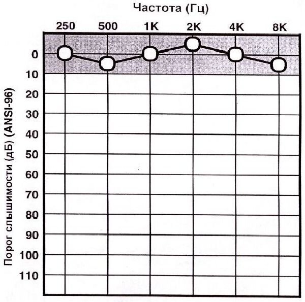Диапазон 20. Тональная пороговая аудиограмма норма. Тональная пороговая аудиометрия норма. Тональная пороговая аудиограмма таблица. Тональная пороговая аудиограмма норма и патология.