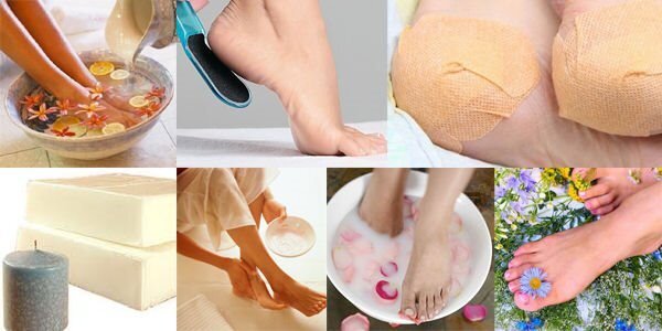 ЛЕЧИМ ТРЕЩИНЫ НА ПЯТКАХ

