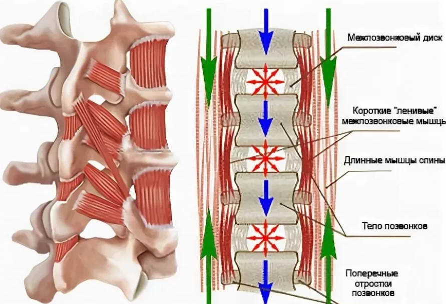 Грыжа сухожилия. Межпоперечные мышцы поясницы. Межпозвонковые суставы в поясничном отделе. Мышечный корсет позвоночника. Мышцы вокруг позвоночника.
