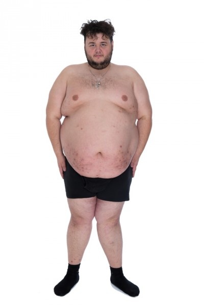 Человек с болезнью.