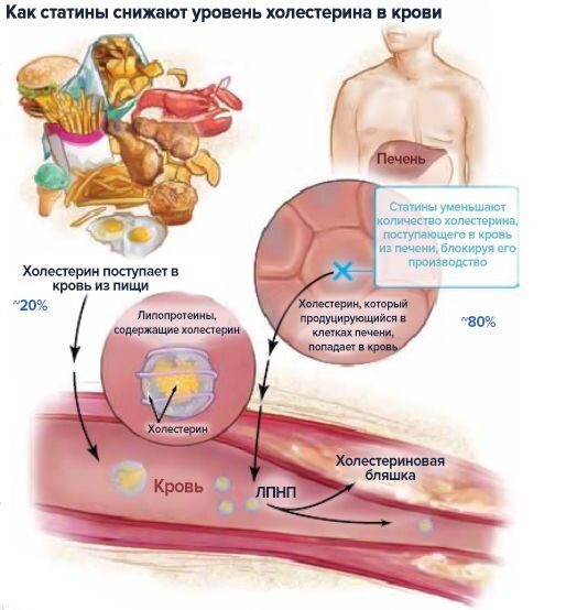 Многих пациентов с атеросклерозом  беспокоит вопрос о состоянии печени из-за вынужденного постоянного приёма статинов.