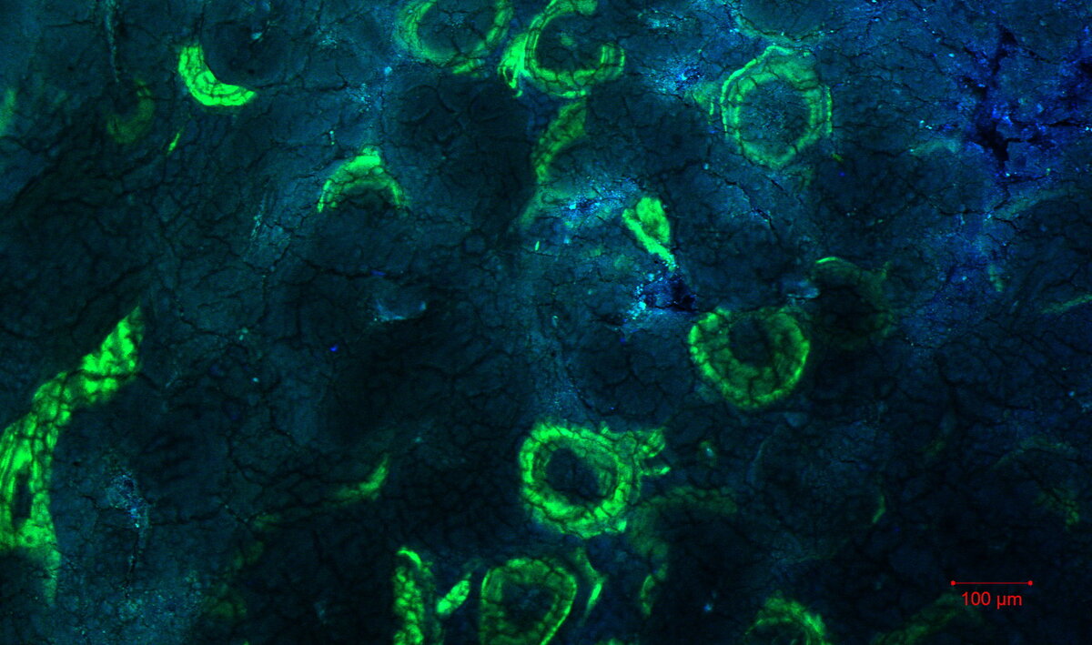 Микроскопия кости