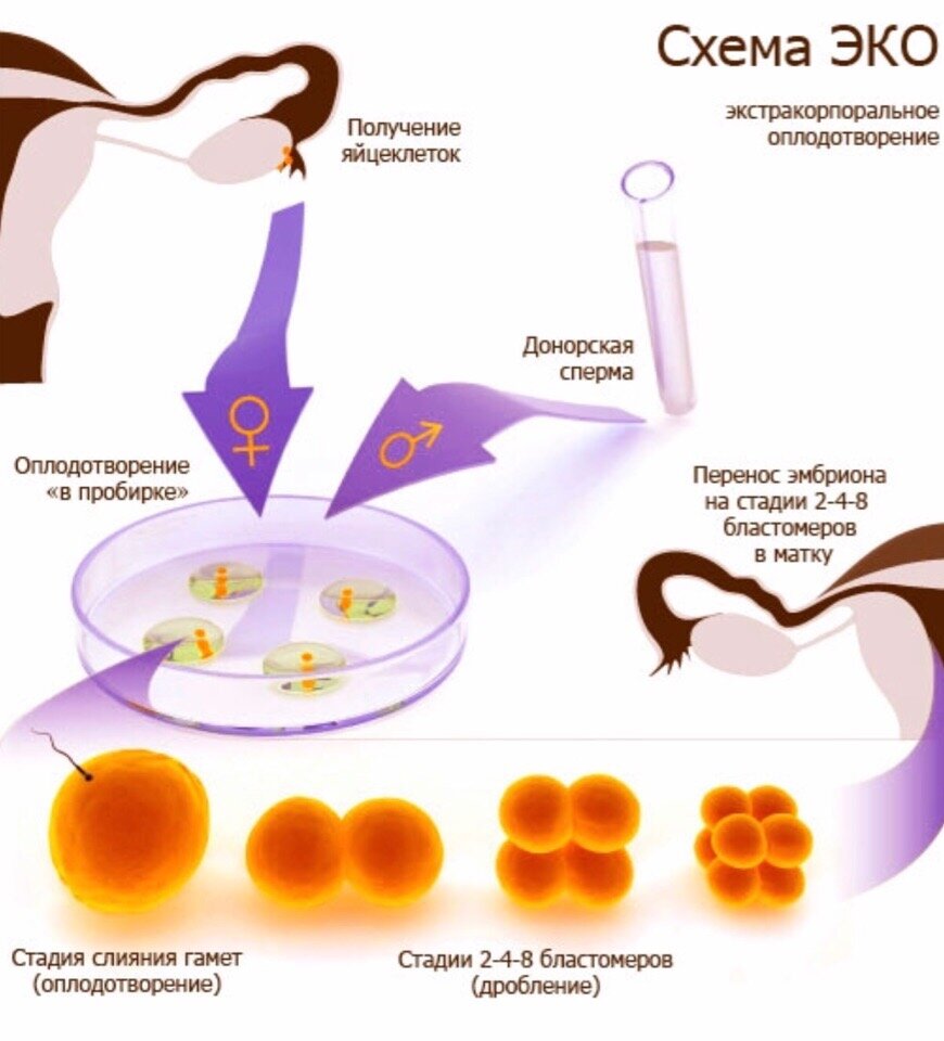 Как улучшить яйцеклетки после 40. Эко оплодотворение яйцеклетки в пробирке. Схема экстракорпорального оплодотворения. Эко оплодотворение этапы. Эко оплодотворение схема.