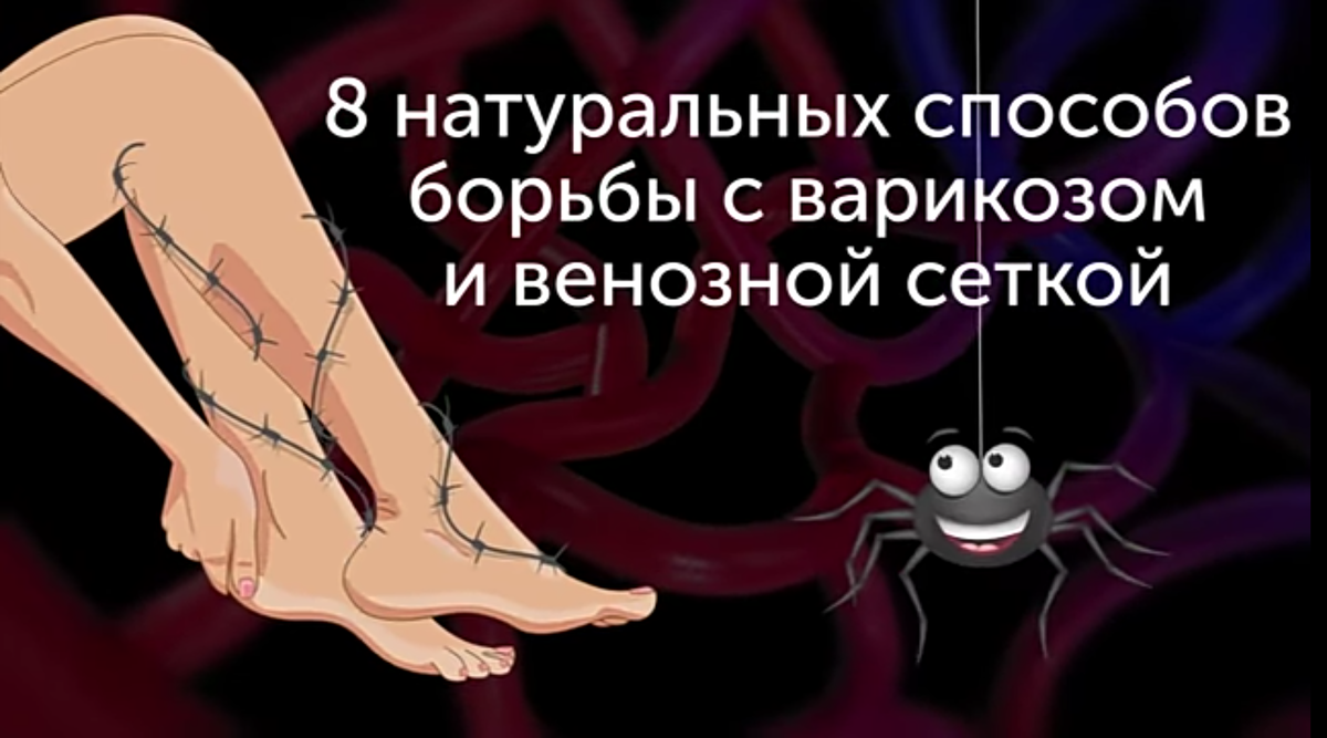 Здравствуйте друзья ! Сегодня поговорим о варикозе. Я нашёл для вас 8 натуральных способов борьбы с варикозом и венозной сеткой.
   Мы все хотим иметь идеальные ноги, но возможно ли это с набухшими, фиолетовыми, варикозным венами ? Не волнуйтесь, эту проблему можно решить за пару недель, просто следуйте этим рецептам и ваши ножки будут выглядеть потрясающе !
  С помощью этих нехитрых советов, вы также сможете предотвратить развитие варикоза. Хотите узнать детали ? Тогда читайте дальше. Но прежде чем вы раз и навсегда забудете о венозной сетке, нажмите подписаться, вот и всё, теперь вы не пропустите классные обновление с Зелёной аптекой !

   N 8  ЯБЛОЧНЫЙ УКСУС !
  Благодаря своим противовоспалительным свойствам, яблочный уксус отлично лечит варикоз и избавляет от венозной сетки. Он помогает снять отек и улучшает циркуляцию крови. Чтобы попробовать, окуните ватный шарик или кусок ткани в раствор яблочного уксуса, разведённого в равной пропорции с водой. Положите компресс на расширенные вены и оставьте, примерно, на 20-30 минут. Когда время выйдет, смойте водой. Вот и всё ! Всё что нужно, это повторять процедуру дважды в день. Вы сразу видите положительные изменения!
  Вот ещё один способ использование яблочного уксуса : просто нанесите его на пораженную кожу и аккуратно массируйте. Эту процедуру стоит выполнять ежедневно, перед сном и повторить на утро. Не применяйте слишком сильное давление, во время массажа.

    N 7. ЧЕСНОК, АПЕЛЬСИНОВЫЙ СОК И ОЛИВКОВОЕ МАСЛО .
    Каждый из этих продуктов прекрасно работает сам по себе, но вместе они действуют с невероятной пользой. Чеснок содержит вещество, под названием аллицин, который помогает предотвратить воспаление кровеносных сосудов. Вдобавок аллицин удаляет из организма вредные токсины и улучшает здоровье в целом. Добавлением апельсинового сока и оливкового масла, только удвоит описанный эффект.
   Рецепт прост : раздавите 6 зубчиков чеснока, смешайте с двумя столовыми ложками оливкового масла и свежевыжатым соком трёх апельсинов. Дайте этой необычной  смеси настояться около 12 часов. Да, вы всё правильно поняли, это средство нужно использовать ежедневно, так что стоит подготовиться. Через 12 часов можно круговыми движениями нанести смесь на вены и оставить примерно на 15 минут, пока она полностью не впитается в кожу. Можно также обернуть это место тканью и оставить на 15 минут, чтобы уменьшить размер вен. Кстати, ежедневное употребление, хотя бы зубчика чеснока, тоже очень полезно, в конце концов, изнутри проблему  тоже нужно лечить. 

      N 6  ПЕТРУШКА .
    Петрушка один из наиболее полезных натуральных продуктов, для лечения варикоза. Главные причины её эффективности в том, что она богата витамином C и  рутином, которые помогают укрепить капилляры и восстановить их работу, уменьшает боль и дискомфорт, вызванные варикозом. Чтобы ощутить волшебное действие петрушки, нарежьте пучок и залейте стаканом воды. Проварите петрушку 5 - 7 минут и дайте остыть. Добавьте немного эфирного масла, окуните в готовую смесь ватный шарик и нанесите на пораженные участки. Как и во всех предыдущих рецептах, нужно повторять процедуру дважды в день, пока не исчезнут раздражающие красные и синие линии на ногах. Не забудьте добавлять петрушку в еду, она отлично повышает иммунитет.

    N 5.  ГАМАМЕЛИС .
   Это растение растёт в северной Америке и в Азии, но его можно купить в аптеках.
    Гамамелис, ещё одно отличное средство для лечения расширенных вен. Он содержит танины и летучие масла, которые помогают восстановить структуру вен, придавая им более естественный вид. Для домашнего лечения гамамелисом, возьмите кусок ткани или ватный шарик, смочите его гамамелисом и положите на пораженный участок, примерно на 10-15 минут. Не забывайте повторять процедуру 2-3 раза в день, в течение месяца, пока не заметите что внешний вид вен улучшается.

     N 4  КАПУСТА . 
    Листы капусты - это отличный источник всевозможных витаминов, клетчатки, магния, кальция и калия.  Которые очень полезная для здоровья. 
 К счастью, эти компоненты могут ещё и уменьшить отёк вен. Нарежьте листья капусты, перемелите их и добавьте немного воды, чтобы образовать кашицу. Нанесите кашицу на отекшие участки и накройте хлопковой тканью. Наша цель, оставить повязку на два часа. Когда время пройдет, смойте эту смесь водой. Если хотите быстрых результатов, повторите процедуру ежедневно, примерно в течение месяца. Эффект вас, точно, не разочарует.

     N 3 ИМБИРЬ .
   Имбирь - это секретное оружие против сосудистой сетки.  Входящие в его состав антиоксиданты, помогают минимизировать риск появления варикоза. Но есть новость ещё лучше, имбирь разжижает кровь, предупреждает образование сгустков и улучшает кровообращение. Так что встречайте единственное, не домашнее средство, в нашем списке. 
  Вкусный и очень полезный, имбирный чай : нарежьте свежий имбирь на кусочки, добавьте к ним стакан кипящей воды и дайте проводиться около 10 минут. Затем процедите воду и добавьте немного мёда.  Готово ! Пейте имбирный чай два-три раза в день и совместите его употребление с другими процедурами из этого списка. Результаты будут поистине невероятными !

      N 2  ОЛИВКОВОЕ МАСЛО И ВИТАМИН Е.
     Оливковое масло широко известна своими полезными свойствами. Но кто знал что оно может помочь избавиться от сосудистой сетки ?  Добавьте к нему витамин Е и вы получите идеальное сочетание, которое облегчает чувство тяжести, делает кожу мягкой и эластичной  Чтобы взять всё лучшее от ингредиентов, смешайте оливковое масло и витамин Е в равных пропорциях, слегка подогрейте смесь на медленном огне, нанесите на кожу и массируйте несколько минут восходящими движениями. Не забудьте повторять процедуру раз, два в день, в течении двух месяцев.
   Вот альтернативное решение с оливковым маслом : добавьте в 2 чайной ложки оливкового масла и четыре - пять капель кипарисового масла, хорошо перемешайте смесь и массируйте ей ноги. В среднем, вы увидите результаты, в течение одной-двух недель.

      N 1.  АЛОЭ ВЕРА, МОРКОВЬ И ЯБЛОЧНЫЙ УКСУС !
  Алоэ Вера. обладает исключительными питательными и противовоспалительными свойствами, что делает его натуральным средством номер один для кожных проблем. Но в сочетании с морковью и яблочным уксусом, оно становится одним из самых эффективных способов уменьшения выступающих вен. И так, давайте посмотрим, как это работает.
  Прежде всего, выдавите сок из трёх листьев алоэ вера, затем пропустить одну морковь через кухонный комбайн и смешайте с соком алоэ, далее добавьте половину чашки яблочного уксуса, для образования однородной массы. Дальнейшие действия совпадают с другими рецептами, нанесите кашицу на пораженные участки вен и оставьте на 30 минут. Не забудьте потом смыть, многие предпочитают нанести средство перед сном оставить на ночь и наутро смыть холодной водой, так что вам решать какой способ вам нравится больше. 
  Вот и всё ! Это одни из лучших, домашних средств для лечения варикоза.  Но даже несмотря на то, что все описанные сегодня рецепты и правда работают, врачи рекомендуют внести некоторые изменения в образ жизни и рацион, чтобы поддерживать долгосрочный эффект. Самое главное подружится с регулярной физической нагрузкой : плавайте, ходите, бегайте, занимаетесь йогой. Чем больше вы двигаетесь, тем  лучше циркулирует кровь. И давайте будем реалистами, всё это может не только помочь вам забыть о венозной сетки, но и подарить идеальную фигуру !
  Ещё одно важное правило : употреблять продукты богатые витамином C и Е. Эти вещества работают как антиоксиданты, укрепляют иммунитет и становятся просто незаменимыми в борьбе с варикозом. И не забывайте о компрессионных чулках - это отличный способ держать венозные клапаны в правильном положении, уменьшая давление в венах. Наконец держитесь как можно дальше от тесной одежды и высоких каблуков.  Последнее практически невозможно для большинства женщин, но даже если вы решите носить каблуки, то постарайтесь хотя бы делать это реже, ваши вены вас только поблагодарят. У вас есть хитрости для борьбы с варикозом ? Поделитесь в комментариях.  Если эта статья оказалось полезной, поставьте лайк и поделитесь  с друзьями, с похожей проблемой. 
  Подписывайтесь на канал.
  Здоровья вам и всего самого наилучшего !!! 