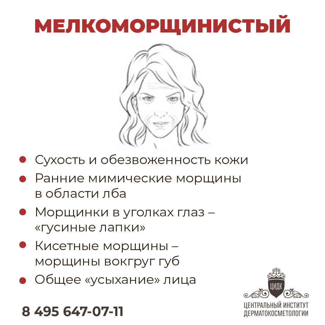 Мелокоморщинистый тип старения