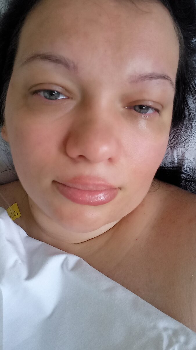 Когда эпидуралка не помогает