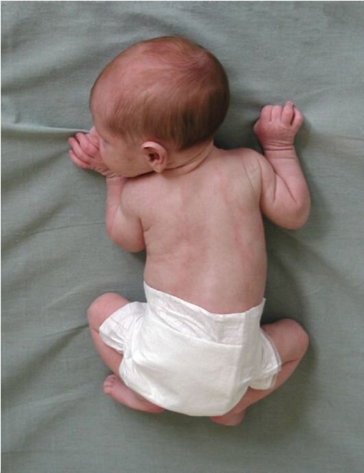 так называемая "поза банана"