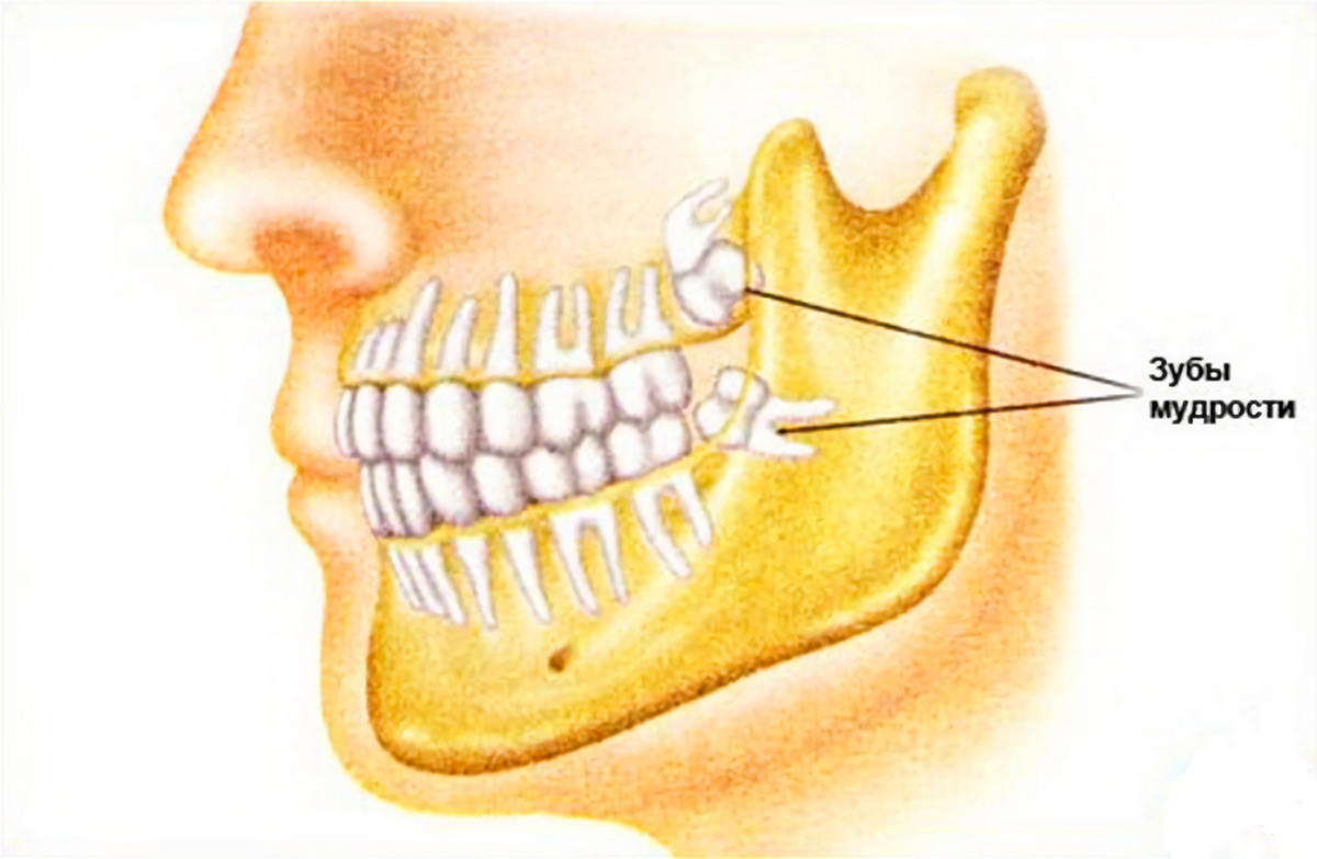 У человека вместе с зубами мудрости