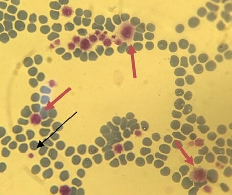 Фото 2. Тромбоциты кошки 2. Иммерсионная микроскопия объектив *100. Черные стрелки указывают на тромбоциты обычных размеров. Красными стрелками указаны макротромбоциты. В верхней части фото агрегация тромбоцитов.