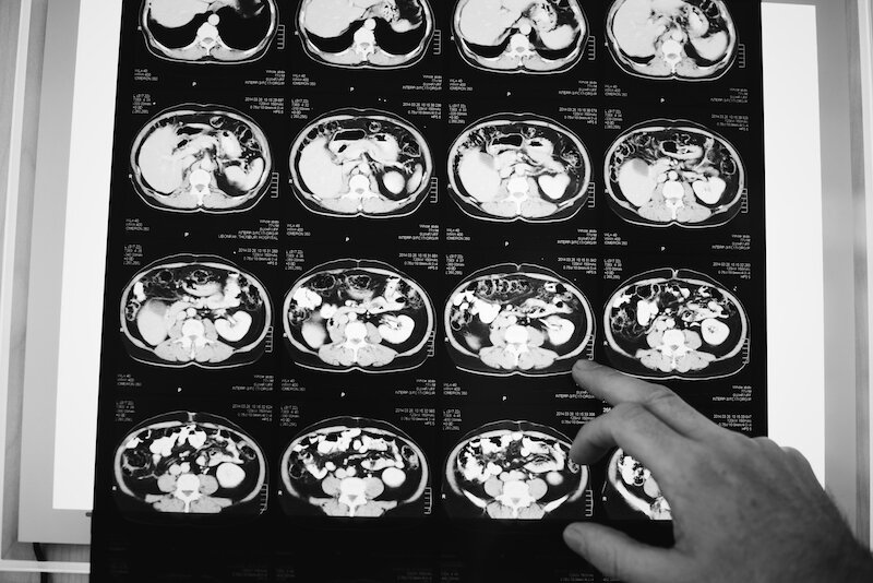 https://www.freepik.com/free-photo/brain-ct-scan-x-ray-film_2997316.htm