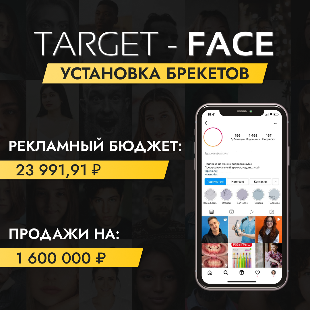 Кейс по таргетированной рекламе на установку брекетов
