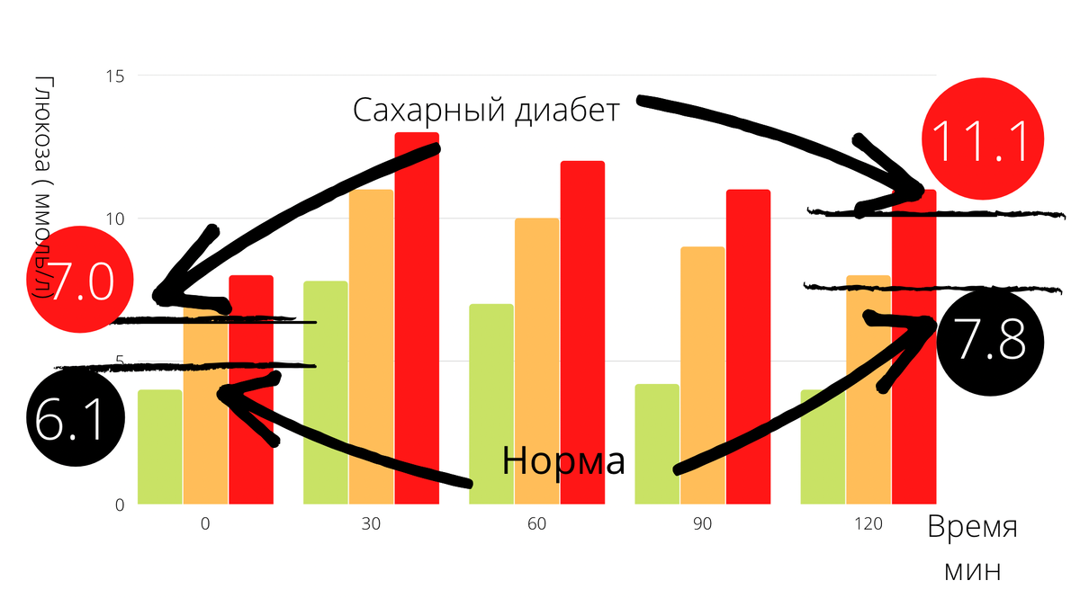 Глюкоза крови в норме, «предиабете» и при СД.