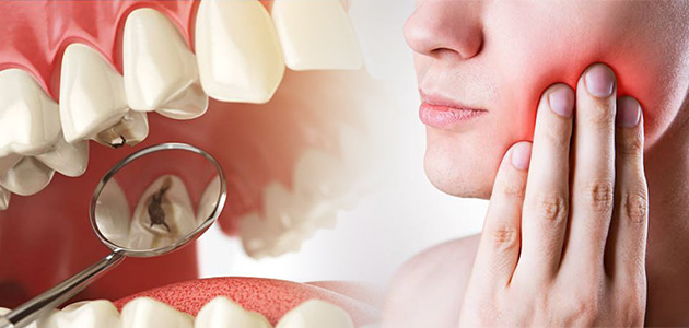 11 причин, почему у вас часто развивается кариес | Стоматология ROOTT ...