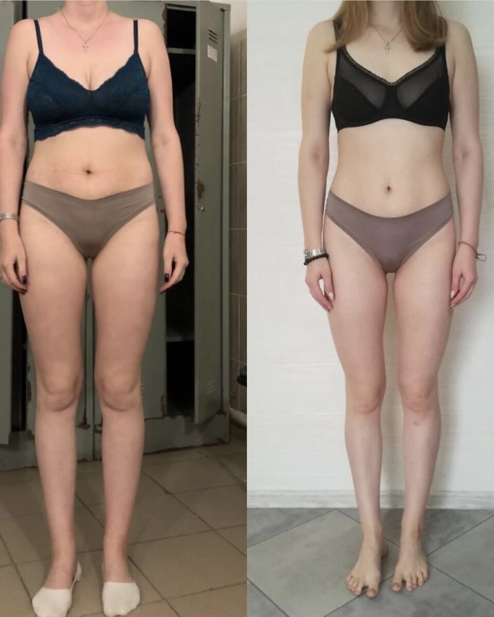 Результаты послеродового восстановления за 2 месяца