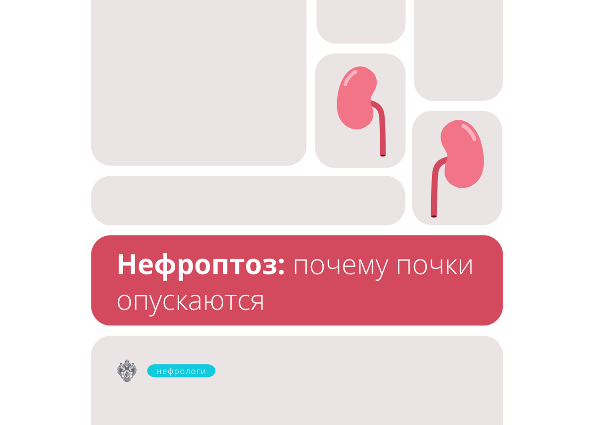 Нефроптоз: почему почка опускается | Клиника Пирогова СПбГУ | Дзен