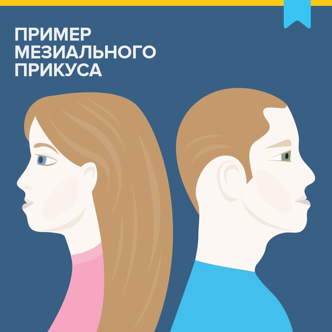 Мезиальный прикус