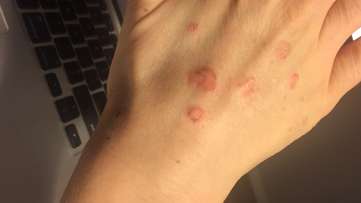 Фото моей руки