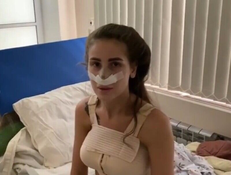 Если учесть, что Насте Голд делал операции тот же доктор, что и бюст Маргарите Ларченко, то становится понятно, что рекламные пластические операции давно и прочно стали стимулом прихода участниц на Дом 2. Перед тем как лечь под нож, надо стать заметной и яркой, постоянно быть в центре обсуждений, пребывая какое-то время на реалити-шоу Дом 2, и только потом удостоиться чести быть перекроенной. Если такие участницы как Алёна Савкина на шоу впервые прибегали к услугам пластических хирургов, то теперь приходят уже переделанные "красотки", недовольные результатами.