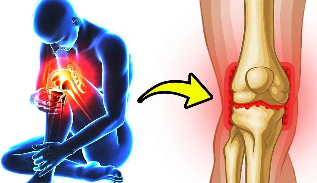 Заболели колени причина. Боль в суставах. Здоровые суставы.
