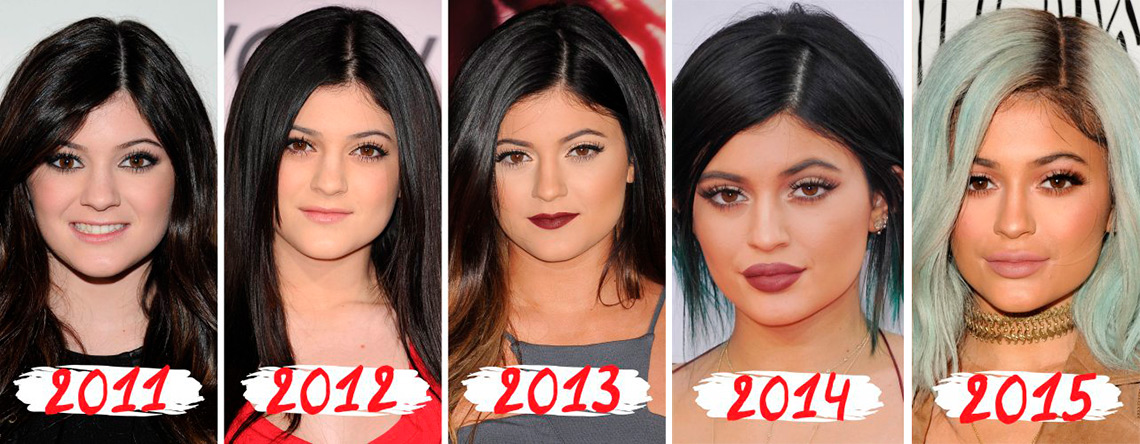 Кайли до и после операции Kylie Jenner before and after a series of plastic surgery