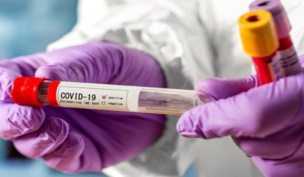 Тест на наличие коронавируса. Источник: coronavirus-monitor.ru