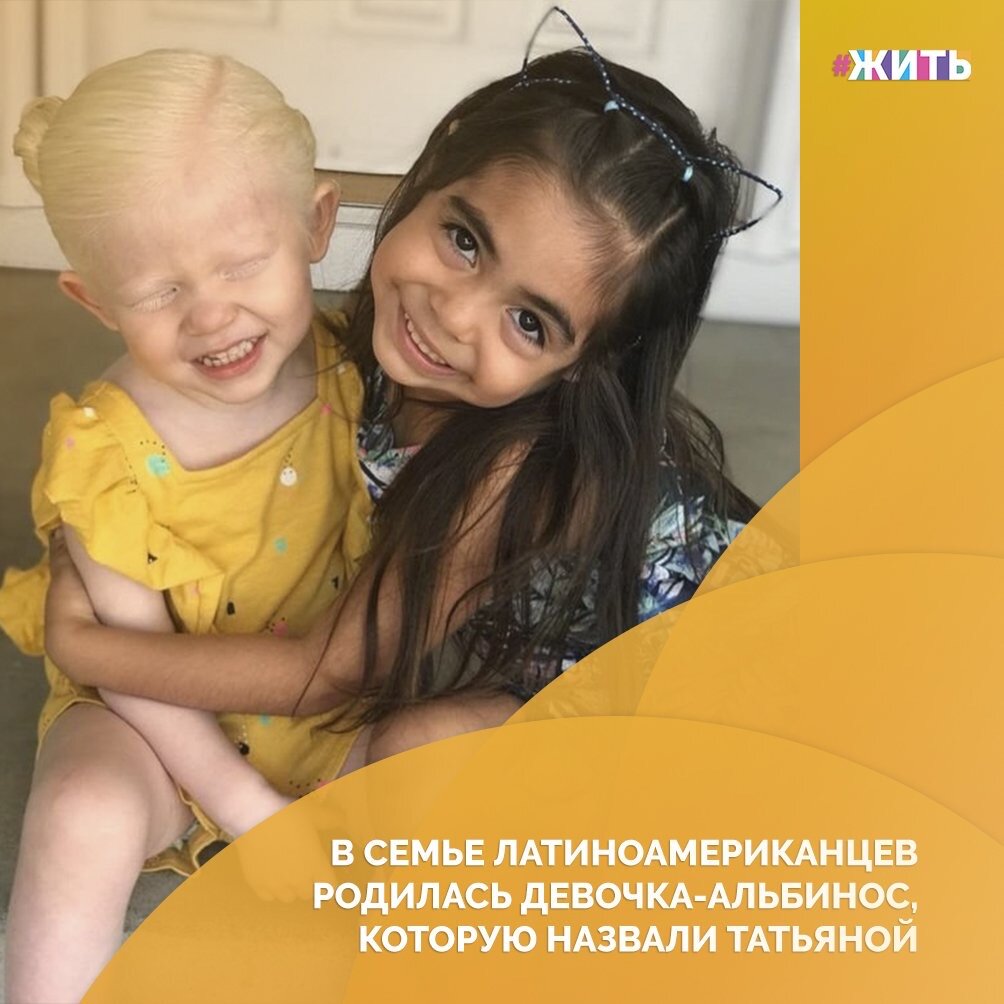 Эдит была потрясена, когда ее младшая дочь Татьяна родилась с кожей цвета слоновой кости и светлыми волосами, поскольку сама Эдит и ее муж Рауль ярко выраженные латиноамериканцы😌

Позднее обнаружилось, что ген альбинизма был у обоих супругов☝️

Сейчас Татьяне три года, а ее сестре - пять и девочка счастлива несмотря на свое отличие от семьи и находится в любви и заботе родственников🙌

Друзья, прддержим малышку и ее родителей❤️

#жить #проектжить