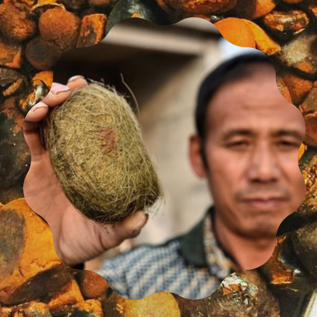 Волосяной безоар желудка. Желудочные камни безоар. Безоар камень. Беозар камень. Безоар камень.