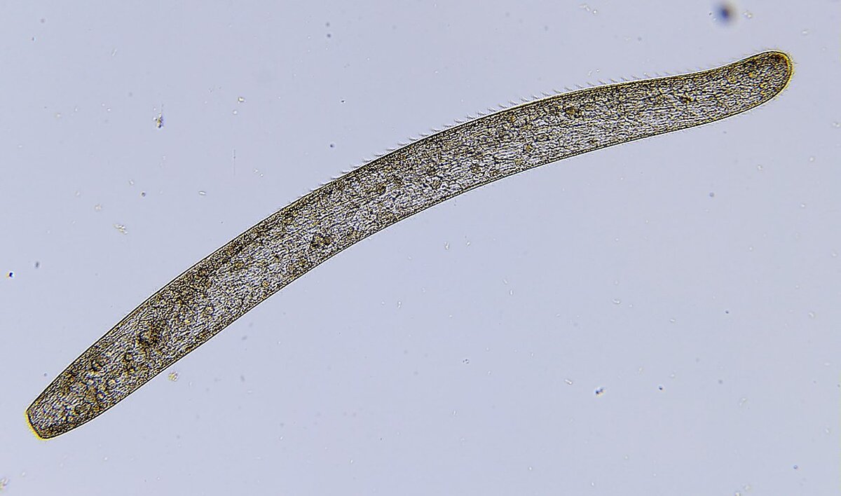 Spirostomum ambiguum. Источник: https://commons.wikimedia.org/w/index.php?curid=58938703