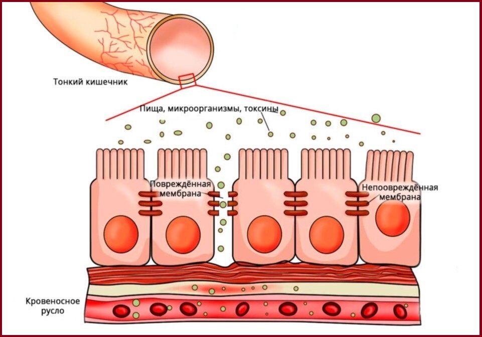 Так молекулы попадают в кровь через "дырявый" кишечник