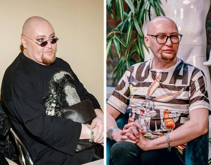 Шура до и после похудения