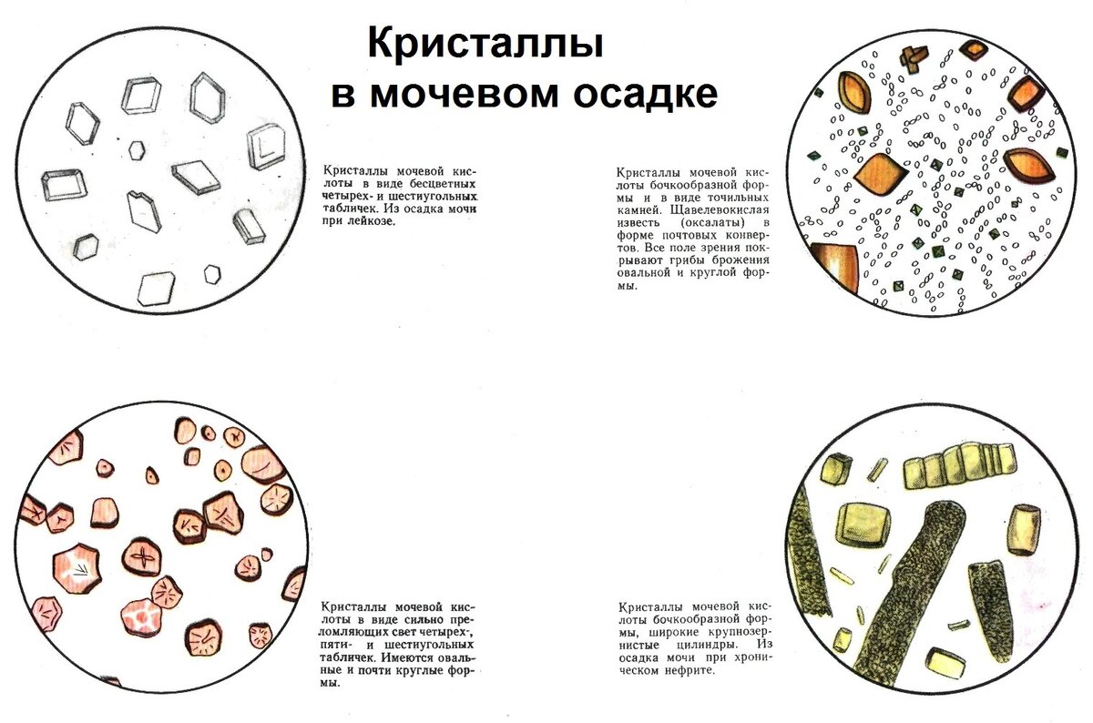 Что такое общий анализ мочи