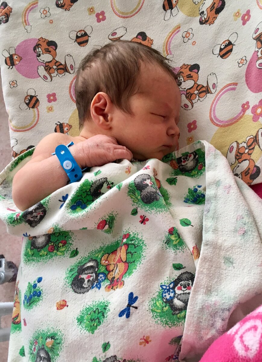 Фото 1 - на второй день после рождения 