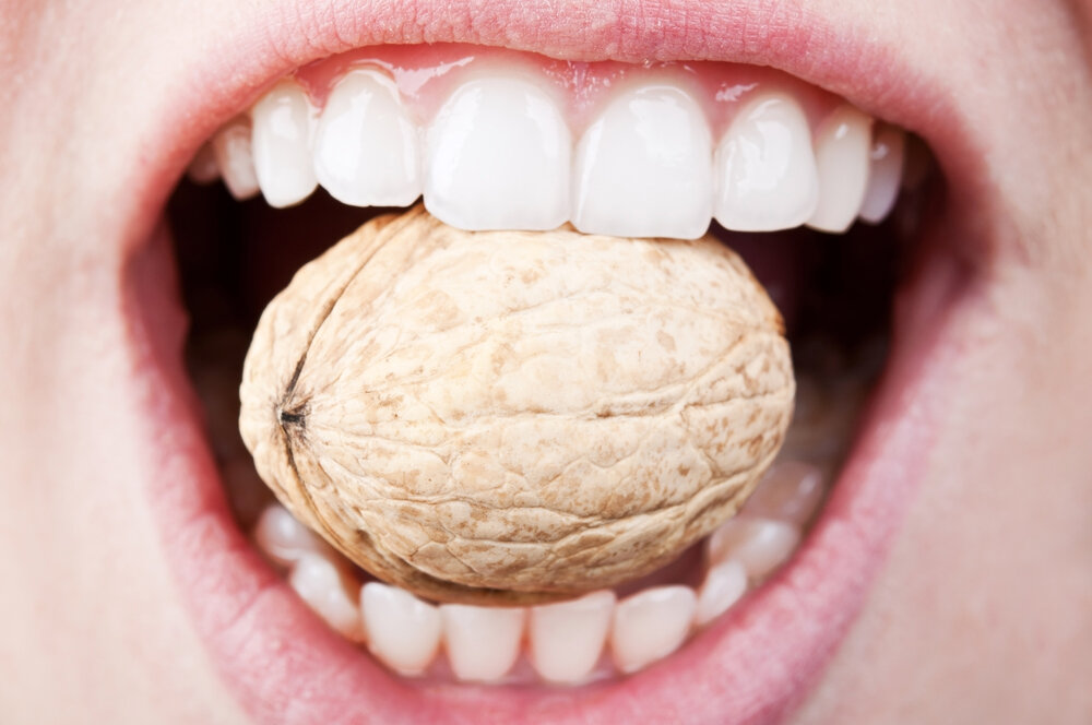 Трещина эмали зуба – причины, лечение