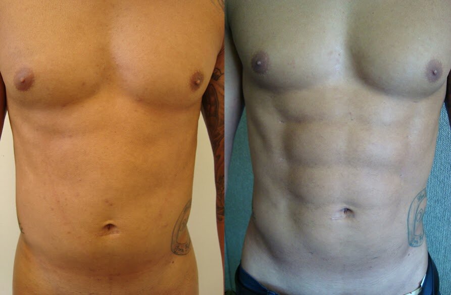 Рельеф мышц. Мужской и женский живот. Убрать жир с живота. Мужской живот без кубиков. Жир на прессе.