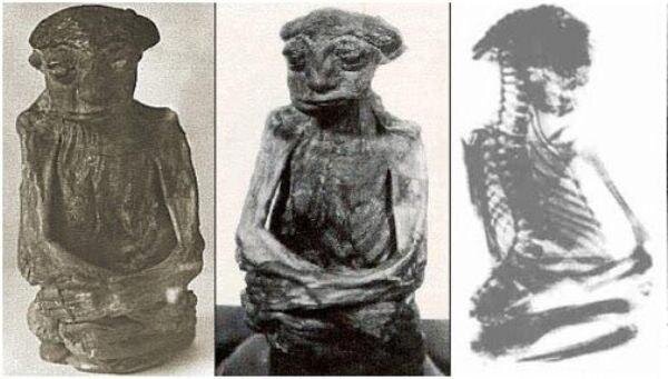 Фотографии и рентгеновский снимок Педрито.