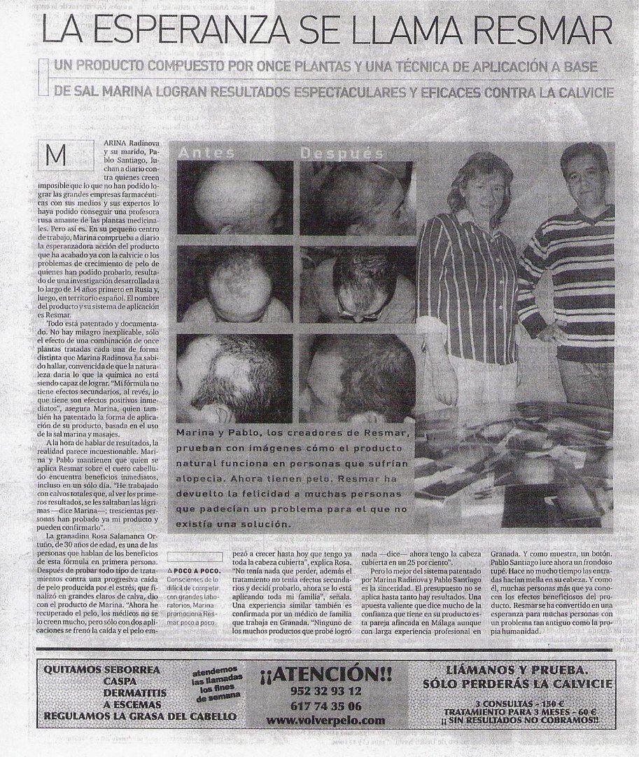 Хуан Карлос АГА и ОА,первый очаг появился на затылке,обратился к дерматологу,который лечил мезотерапией,сначала волосы выросли,через 3месяца заново выпали,при повторных уколах,зона стала расширятся и появились новые очаги,потом потеря бровей,ресниц части бороды.Когда обратился ко мне за помощью,был в состоянии разочарования в жизни,его не брали на работу.Самое трудное при масках с рес-маром,было восстанавливатъ ресницы,рес-мар когда попадает на глаз не вредит,но очень щипит,в зоне,где была сделана повторно мезотерапия,тоже волосы заново не выросли,хорошо что Хуан Карлос догадался и не делал инъекции по всей голове!