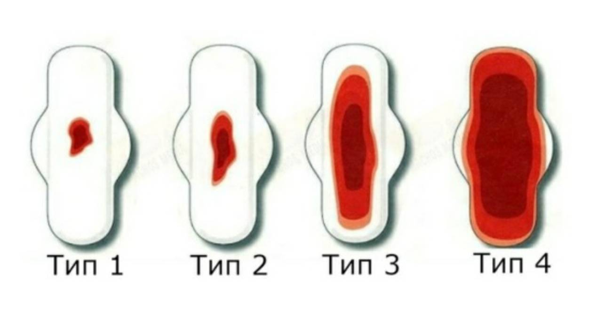 Почему месячные идут больше чем обычно. Обильность менструации. Цвет месячных в первый день.