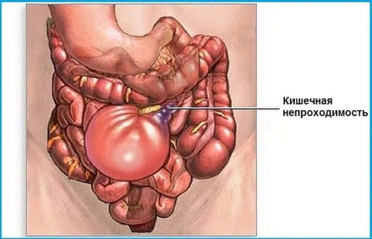 яндекс картинки