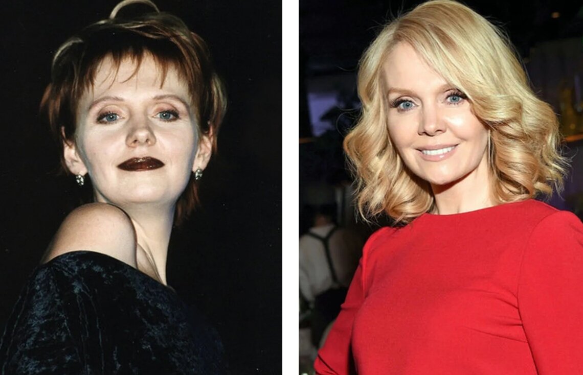 лейсан утяшева до пластики. надежда бабкина пластические операции. звезды пластика до и после. мария горбань до пластических операций. российские звезды до и после операции.