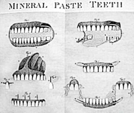 Фарфоровый протез 18 век 