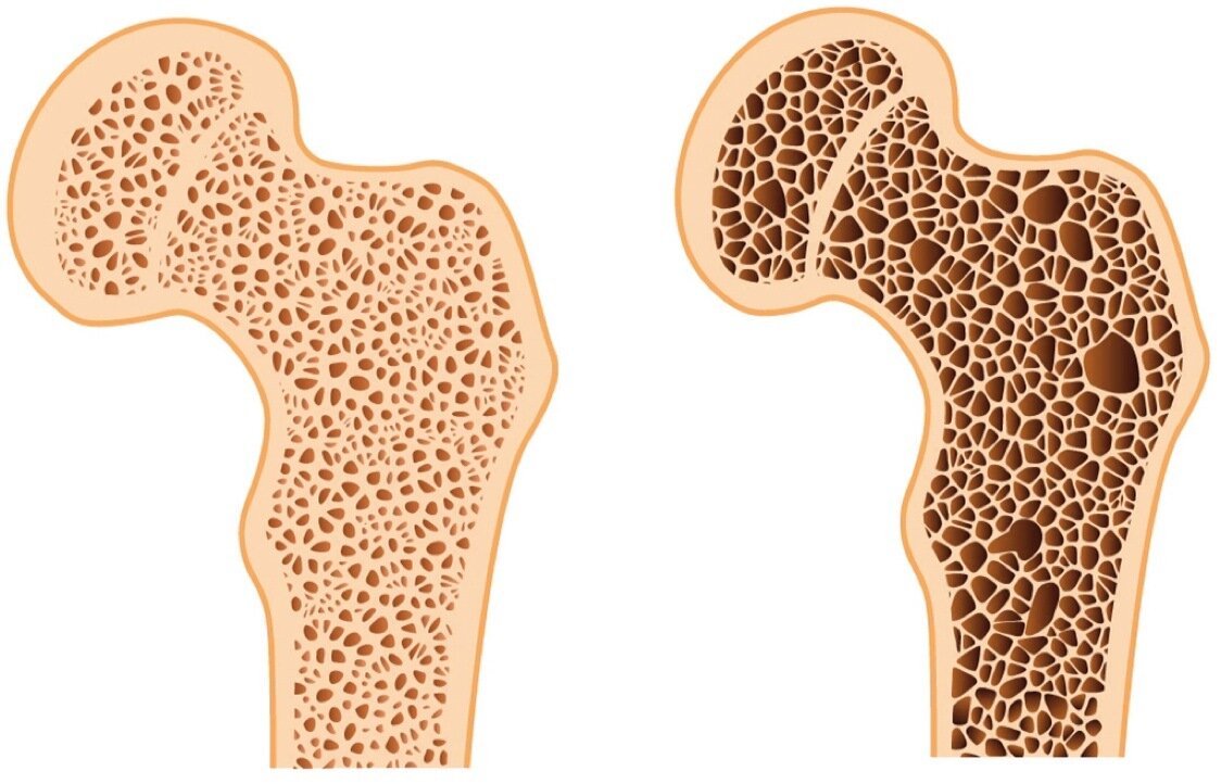 Источник: drevmass-spina.ru