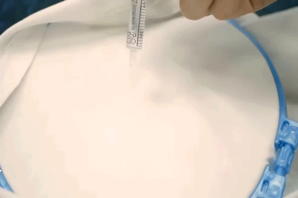 -5