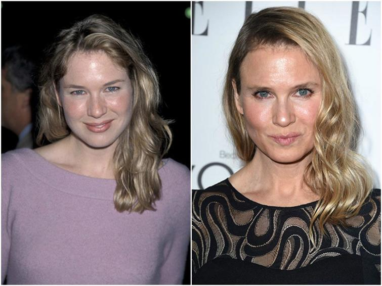 Рене и раньше прибегала к услугам специалистов: ее выдавали сильно изменившаяся форма губ, неестественно натянутая кожа. Но сейчас Рене поразила поклонников узким и совсем не знакомым разрезом глаз и рельефной блестящей кожей. Интересно,продолжит ли новая Рене актерскую карьеру? Совсем не узнать с новым лицом, но на удивление симпатично.