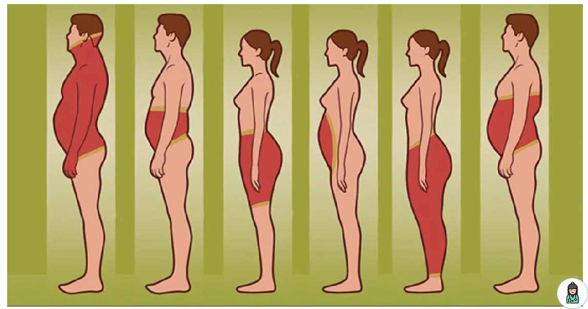 В каком месте растет. Типы ожирения живота у женщин. Типы жировых отложений у женщин. Форма живота при ожирении. Места отложения жира у женщин.