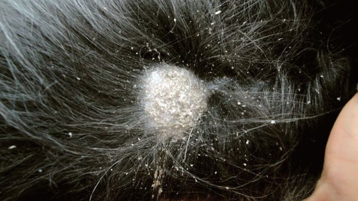 Фото дерматита на голове