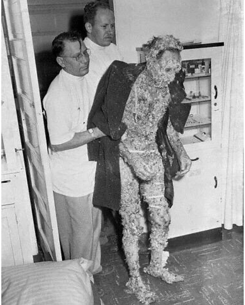 Это случилось в 1987 году в Лондоне. Лучшего доктора Англии пригласили в городскую больницу для осмотра «ужасного пациента». Далее с его слов:» Утром я приехал в больницу, где меня встретила медсестра и отвела в кабинет. Приказав мне ждать, она куда-то ушла. Спустя 30 минут дверь кабинета открылась и я буквально закричал от ужаса!
